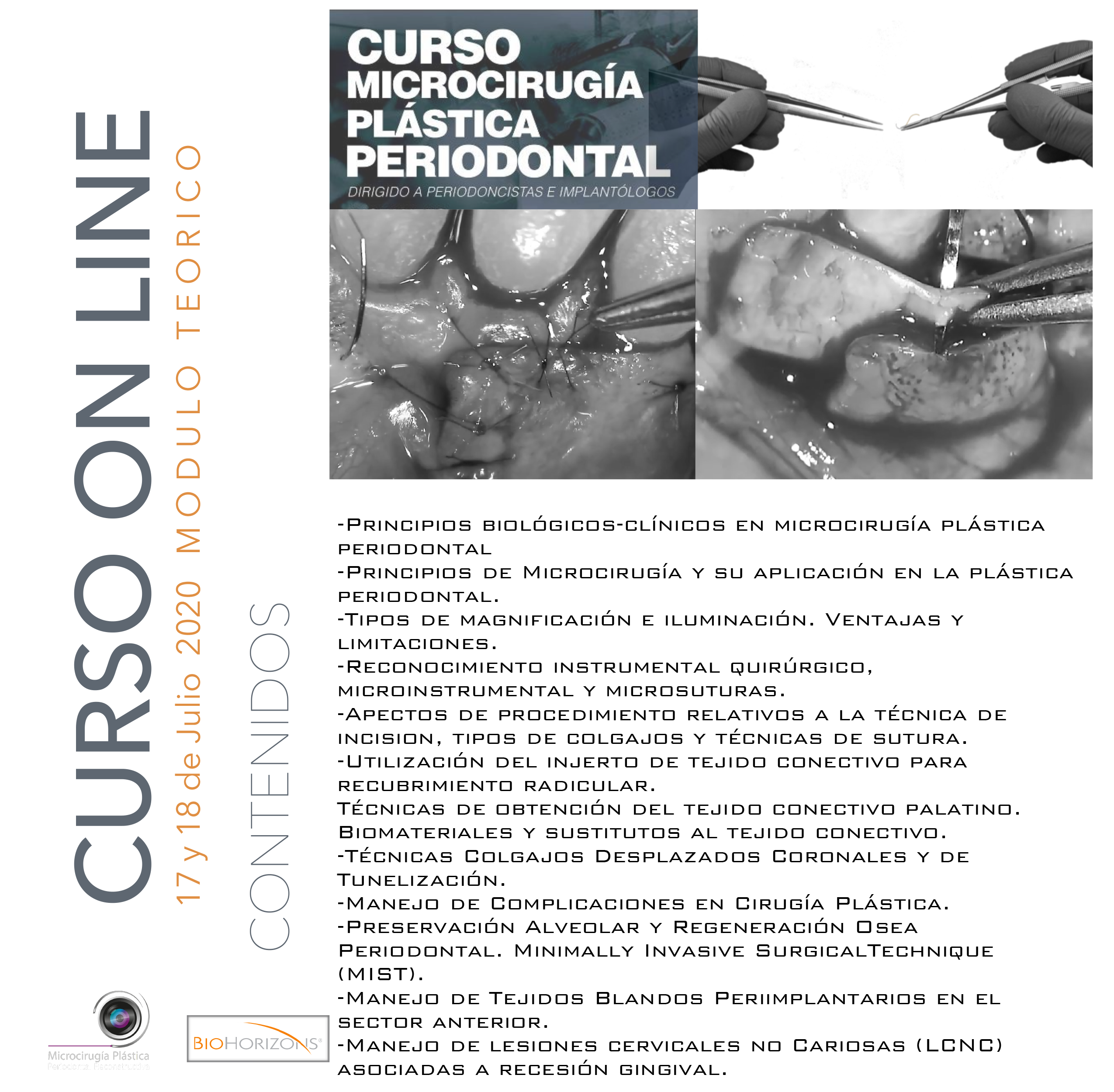 microcirugia-plastica_perodontal